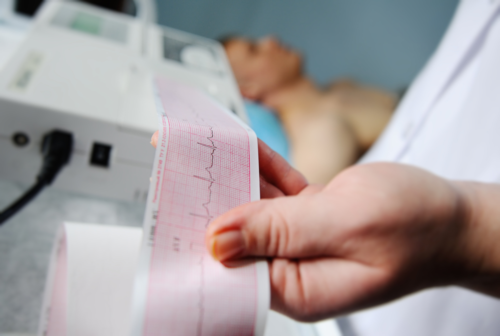NVTI Diploma in ECG Technology
